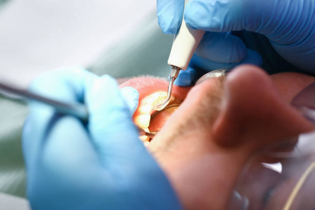 Best Tooth Infection Emergency Dentist  in Concord, CA