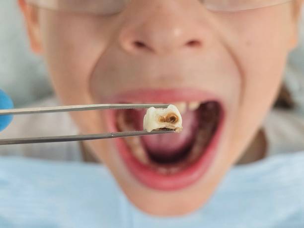 Best Emergency Pediatric Dentist  in Concord, CA